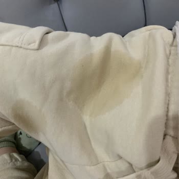 Molfix Bebek Bezlerinde Emicilik Sorunu