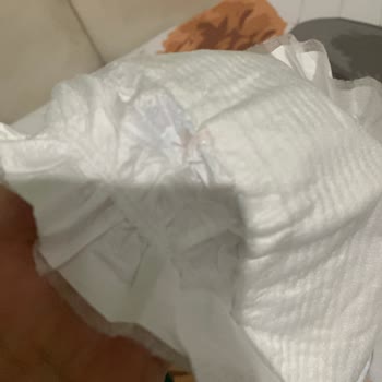 Molfix Bebek Bezlerinde Emicilik Sorunu