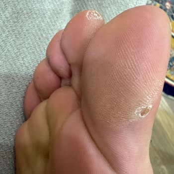 Ayağımı Mahveden Ayakkabı Ve Hızlı Değişim Talebi