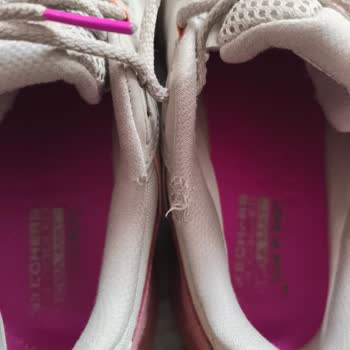 Skechers Ayakkabısında Kısa Sürede Yırtık, Kir Ve Kötü Koku