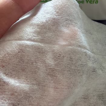 Kuru Ve İnce Gelen Baby Turco Islak Mendil'e İade Reddi