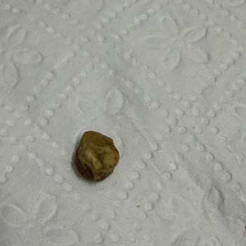 Liva Pastanesi’nden Baklavadaki Taş Parçası Gıda Güvenliği İhlali
