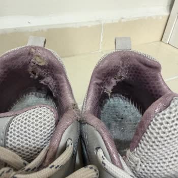 Skechers Ayakkabıda Erken Deformasyon Ve Rahatsızlık, İade Talebi