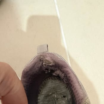 Skechers Ayakkabıda Erken Deformasyon Ve Rahatsızlık, İade Talebi