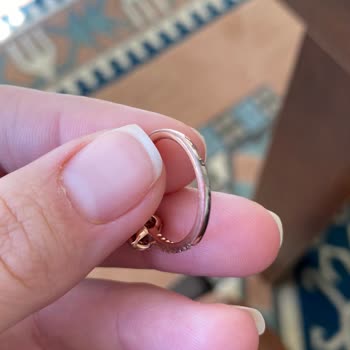 Renk Değiştiren Yüzük Ve Mağazanın Destek Vermemesi