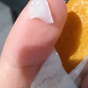 McDonald's Burgerinde Sert Plastik Parça Dişimi Tehdit Etti