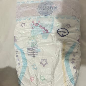 Kampanyalı Molfix Bebek Bezlerinde Sızdırmazlık Sorunu Ve İade Talebi