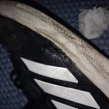 Deichmann Ayakkabısının Kısa Sürede Yırtılması Ve Müşteri Hizmetindeki İhmalkarlık