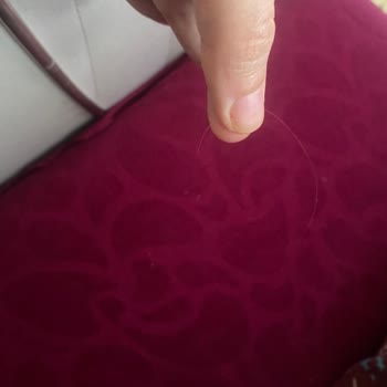 Kavrulmuş Yer Fıstığından Kıl Çıkması Hijyen Sorunu Ve İade Talebi