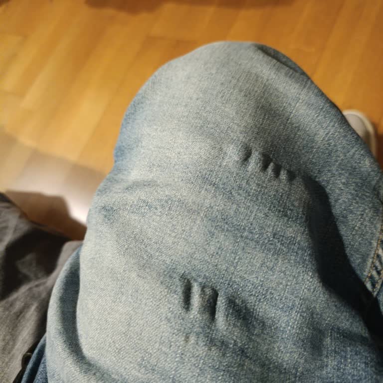 Levi’s Pantolonlarım Deforme Oldu, Kağıt Fatura Eksikliği Nedeniyle Değişim İsteğim Reddedildi