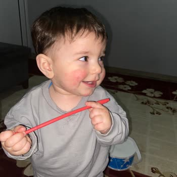 Bebekte Şampuan Kullanımının Ardından Şiddetli Kızarıklık Ve Kaşıntı