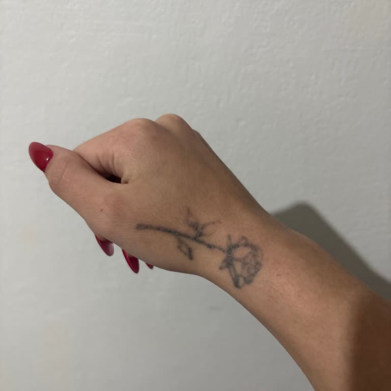 Amor Vip Beauty | Bursa Dövme Sildirme İşlemi