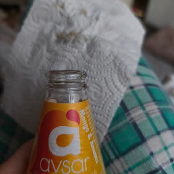 Avşar Kapak Altı Paslanma Şüphesi Ve Kontrol Talebi