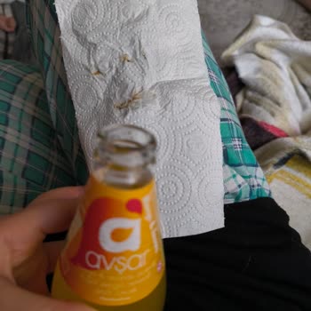 Avşar Kapak Altı Paslanma Şüphesi Ve Kontrol Talebi