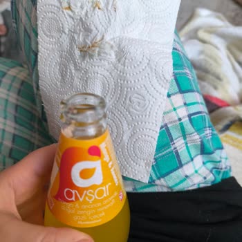 Avşar Kapak Altı Paslanma Şüphesi Ve Kontrol Talebi