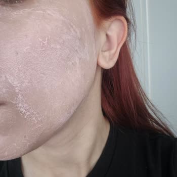 Sinoz Pink Touch Güneş Kremi Cildimde Pütürlü Ve Yamalı Görünüm Oluşturdu