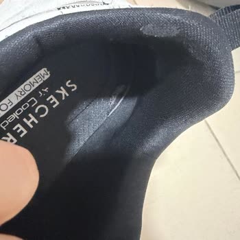 Skechers Ayakkabısında Erken Topuk Ağrısı Ve İade Talebi