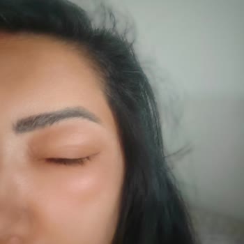 Uraw Mavi Sprey Kullanımından Sonra Alerjik Reaksiyon Ve İade Reddi