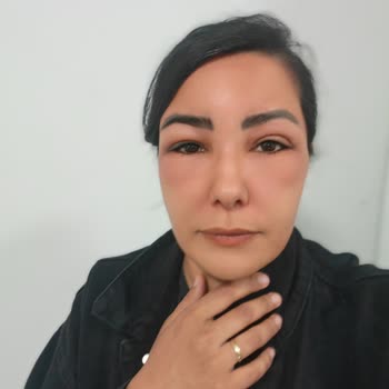Uraw Mavi Sprey Kullanımından Sonra Alerjik Reaksiyon Ve İade Reddi