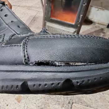 Skechers Ayakkabımda Yırtılma, N11 Mağazası İadeyi Reddetti