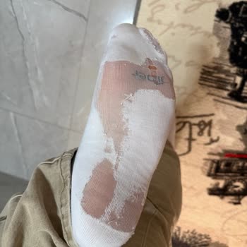 Ürün Yırtılması Ve WhatsApp Destek Hattından Cevapsızlık