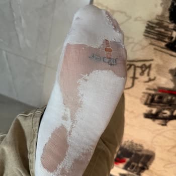 Ürün Yırtılması Ve WhatsApp Destek Hattından Cevapsızlık