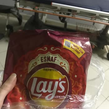 Lays Cipsinde Uzun Kıl Benzeri Yabancı Madde Ve Kalite Kontrol Sorunu