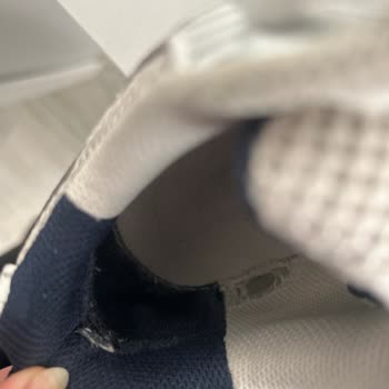 Temizco Ayakkabı Temizliği Sonrası Oluşan Ağır Deformasyon Ve Ağrı Şikayeti
