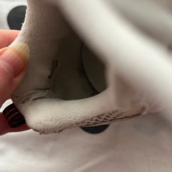 Temizco Ayakkabı Temizliği Sonrası Oluşan Ağır Deformasyon Ve Ağrı Şikayeti