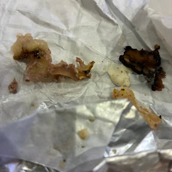 Arby’s Nautilus Şubesinde Yanık Et Ve Yağlı Ürün Şikayeti