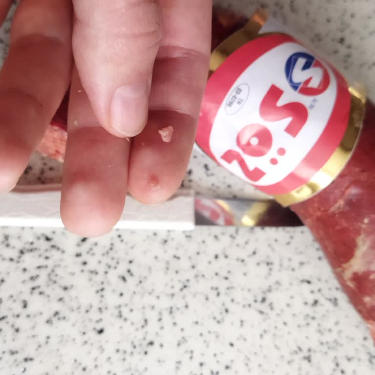 Sucukta Sinir Ve Kemik Parçaları Sorunu