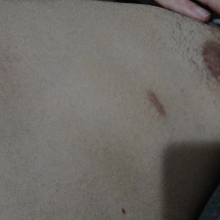 Dr. Bilgehan Aydın İzlerin Geçmemesi Ve Sözlerin Tutulmaması