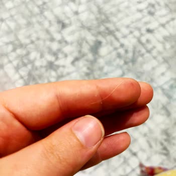 Milano Grolet Üründe Hijyen İhlali Ve Yabancı Madde Tespiti