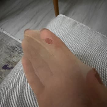 Penti Külotlu Çorap Tek Kullanımda Patladı, 300 TL İadesi Talebi