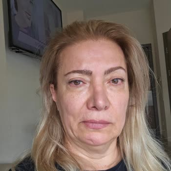 Dermaelite Güzellik Merkezi Baskı İle İşlem Yaptılar Ve Sağlığımdan Oldum