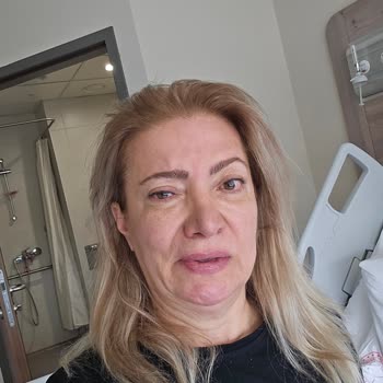 Dermaelite Güzellik Merkezi Baskı İle İşlem Yaptılar Ve Sağlığımdan Oldum