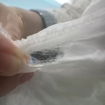 Sleepy Bebek Bezindeki Yırtıklar Kaçırma Sorununa Yol Açıyor