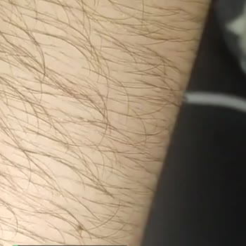 Lüks Karadeniz Muavin Elimi Yaktı