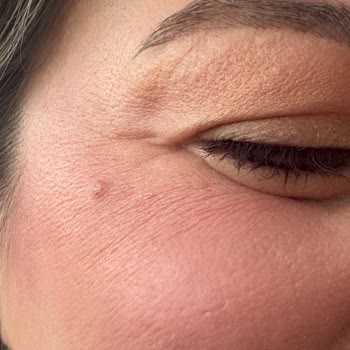 L'uva Aesthetics Hatayı Kabul Etmedi