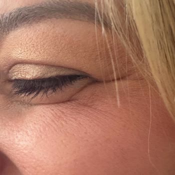 L'uva Aesthetics Hatayı Kabul Etmedi