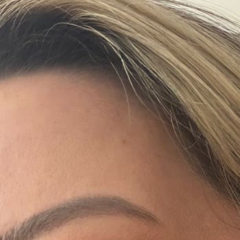 L'uva Aesthetics Hatayı Kabul Etmedi