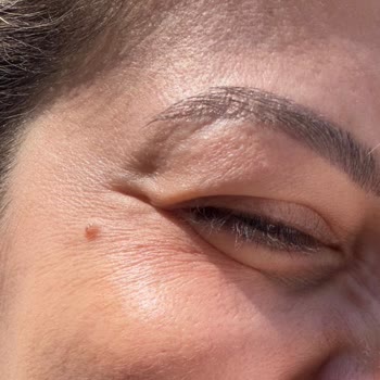 L'uva Aesthetics Hatayı Kabul Etmedi