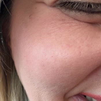 L'uva Aesthetics Hatayı Kabul Etmedi