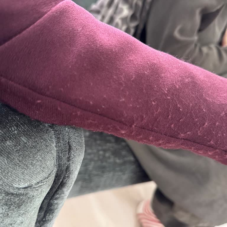 Abiye Kollarındaki Ani Tüylenme Ve Satıcıdan Cevapsızlık Nedeniyle İade Talebi
