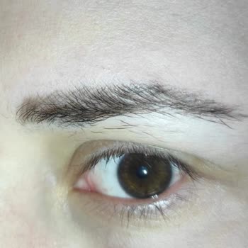 Microblading İşleminde Aşırı Kanama Ve Kalıcı Sonuç Sorunu Ücret İadesi Talebi