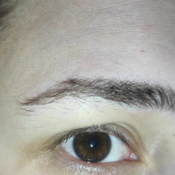 Microblading İşleminde Aşırı Kanama Ve Kalıcı Sonuç Sorunu Ücret İadesi Talebi