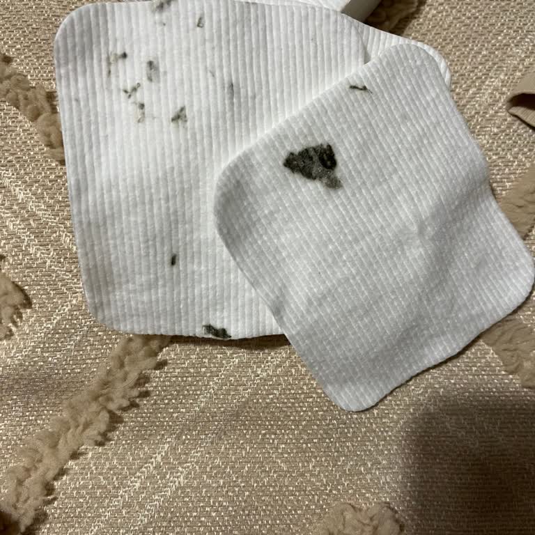 Bebek Pamuğunda Küf Benzeri Lekeler Ve Göz Enfeksiyonu