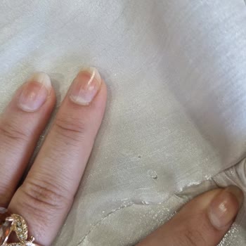 Tesettür Elbisesinde Dikiş Kusurları Ve İlgisiz Müşteri Hizmeti