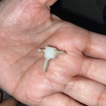UNO Ekmeğinde Bulunan Sivri Plastik Parçalar Hakkında Açıklama Ve İade Talebi