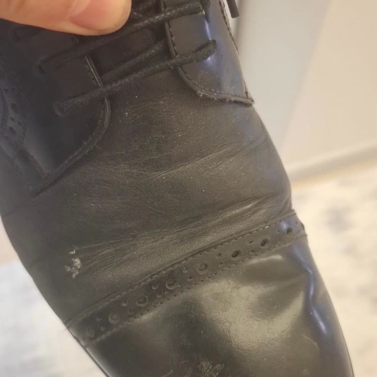 Ayakkabının Ön Kısmındaki Çökme Ve Bilgilendirme Eksikliği